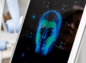 A close-up of the device panel for Emface, an alternative for Botox near Dublin, OH