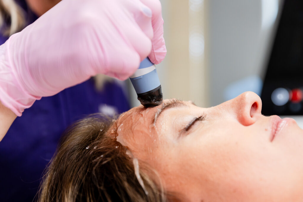 Exion face rejuvenation treatment