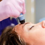 Exion face rejuvenation treatment