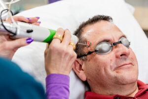 A patient wears protective goggles as a provider performs a treatment for facial aesthetics in Columbus, OH.