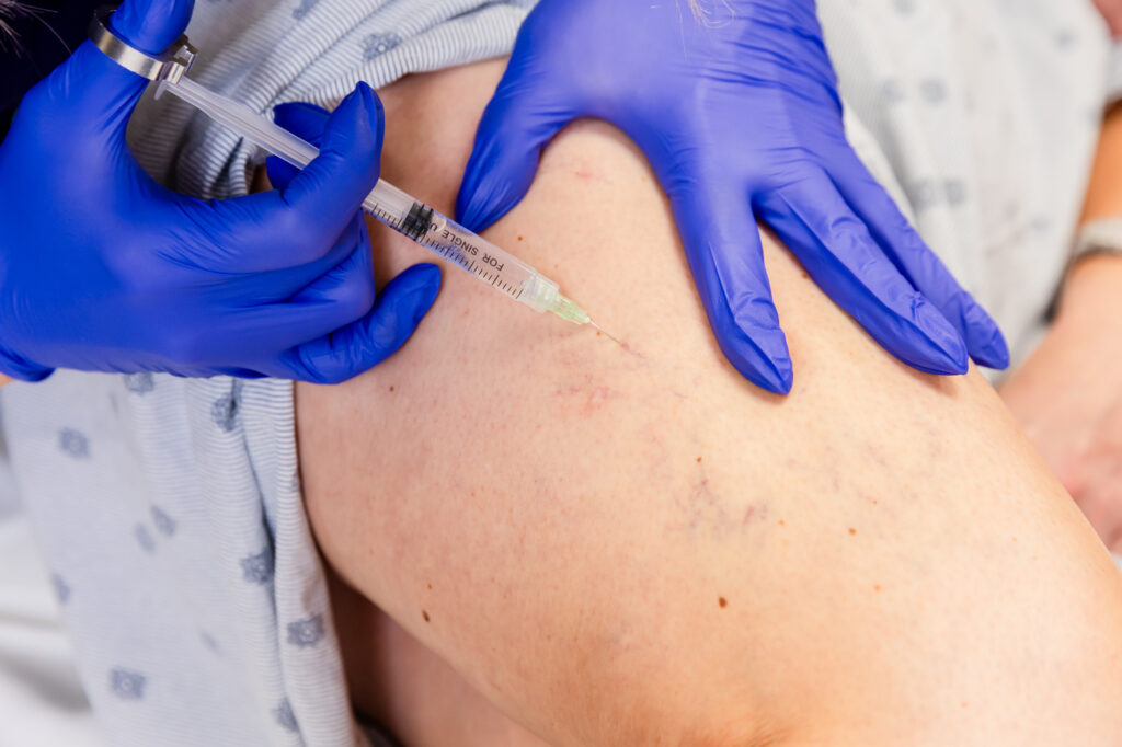 A close-up of a provider's gloves performing sclerotherapy near New Albany, OH