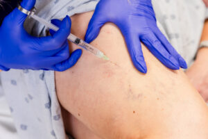 An example of Sclerotherapy near Upper Arlington, OH